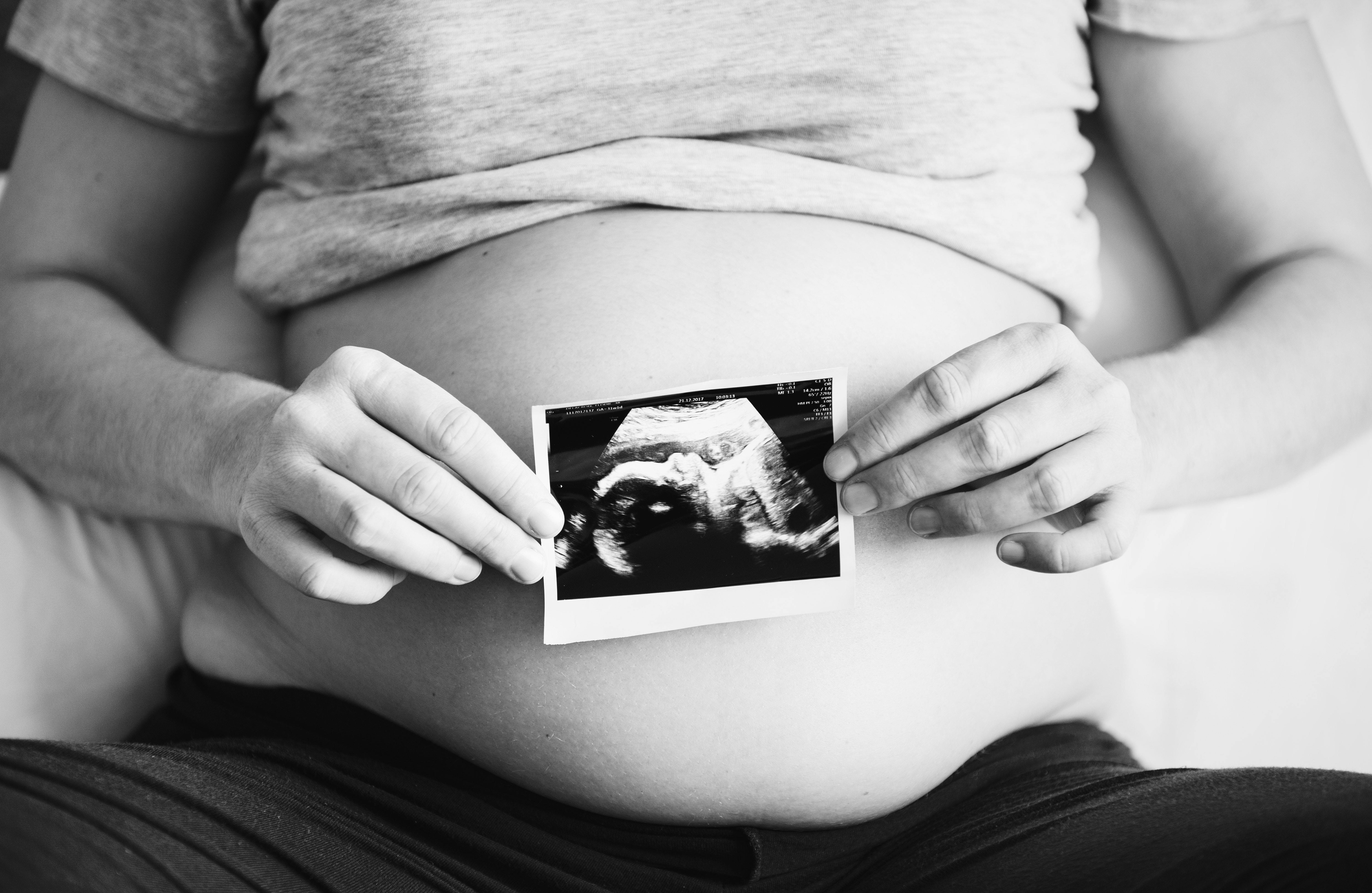 Woman holding scan picture in front of her bump